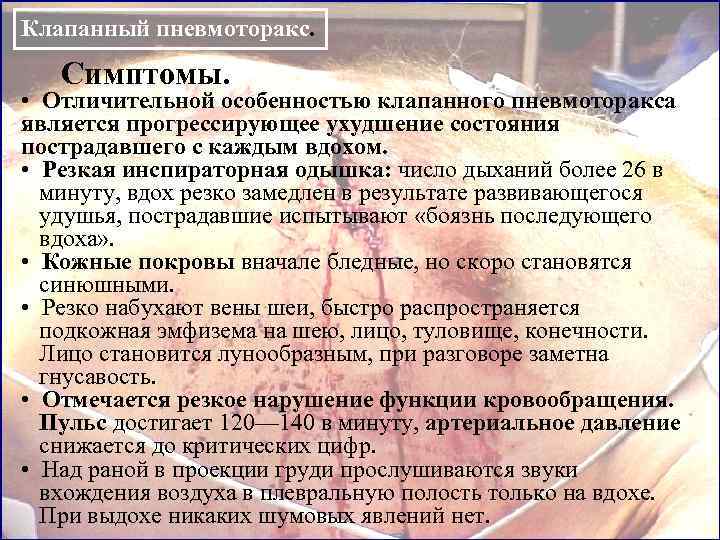 Клапанный пневмоторакс.  Симптомы.  •  Отличительной особенностью клапанного пневмоторакса является прогрессирующее ухудшение