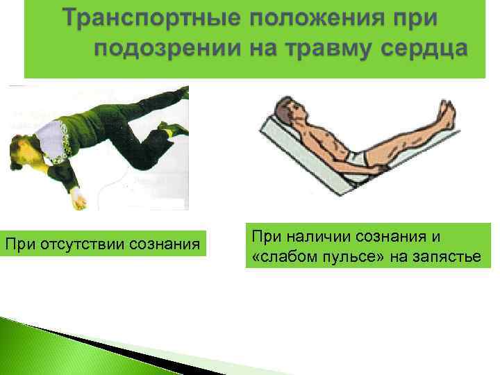 При отсутствии сознания  При наличии сознания и      «слабом