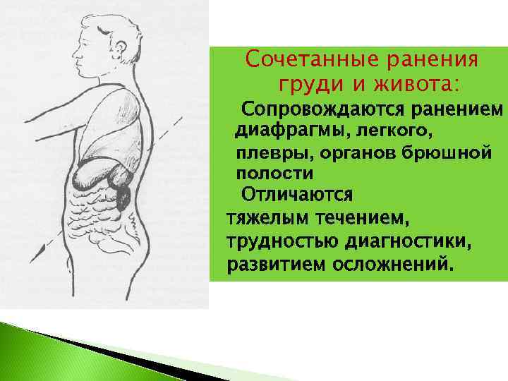   Сочетанные ранения  груди и живота:  •  Сопровождаются ранением 