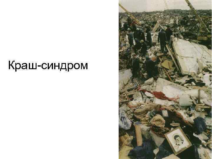 Краш-синдром 