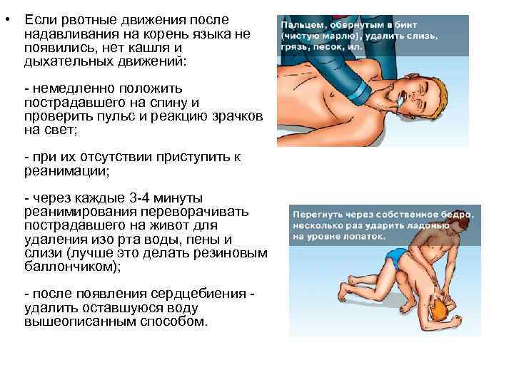  • Если рвотные движения после  надавливания на корень языка не  появились,