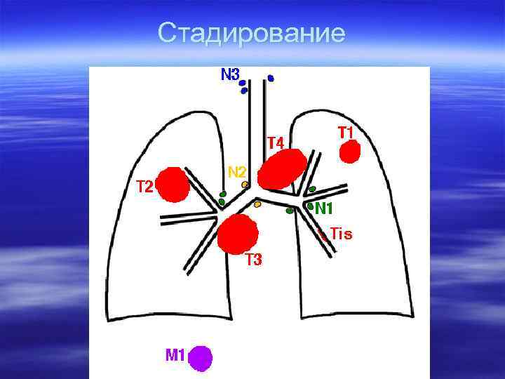 Стадирование 