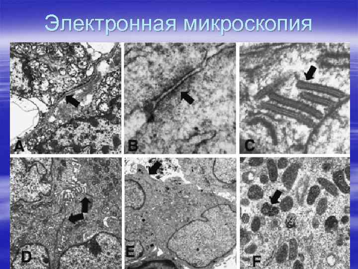 Электронная микроскопия 