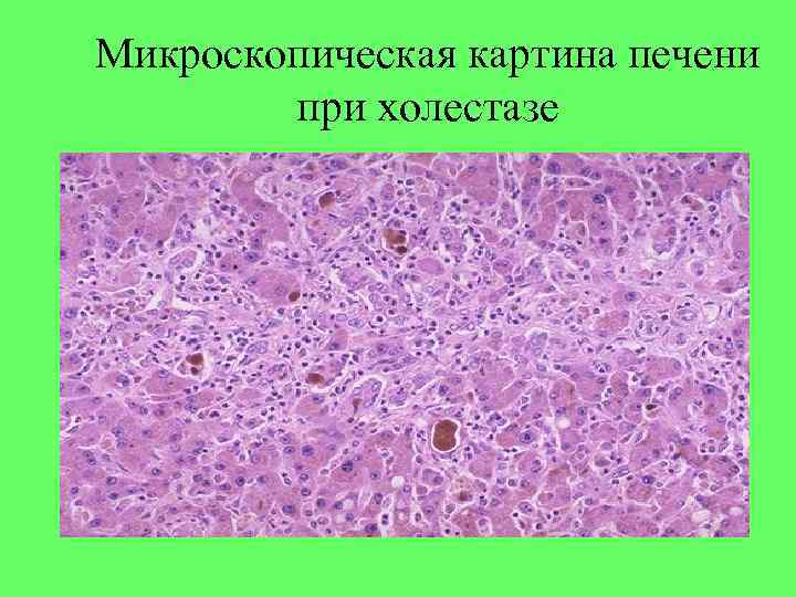 Дистрофии патанатомия презентация