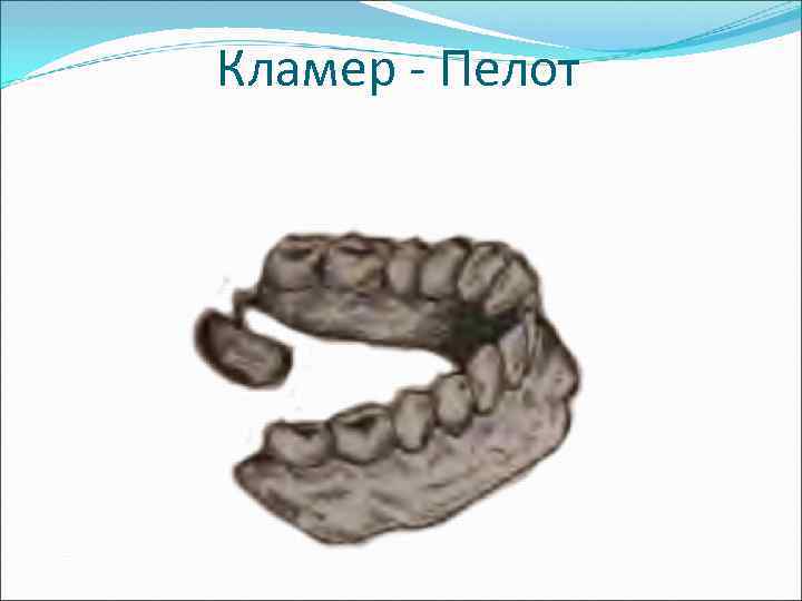 Кламер - Пелот 