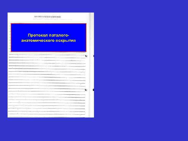   Протокол паталого- анатомического вскрытия 