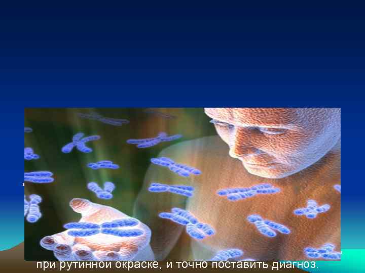  • Огромный вклад в диагностику хромосомных  болезней внесли генетики, внедрив в практику
