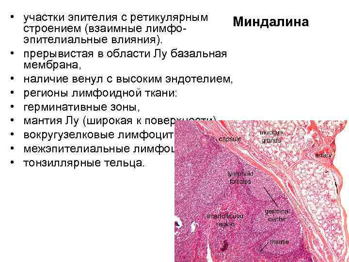  • участки эпителия с ретикулярным  Миндалина  строением (взаимные лимфо-  эпителиальные