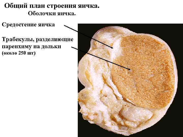 Общий план строения яичка. Оболочки яичка. Средостение яичка Трабекулы, разделяющие паренхиму на Общий план строения яичка. Оболочки яичка. Средостение яичка Трабекулы, разделяющие паренхиму на
