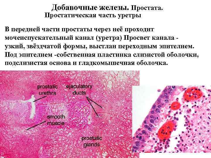 Части простаты. Анатомия простатической части уретры. Предстательная часть мужского мочеиспускательного канала. Эпителий предстательной железы.