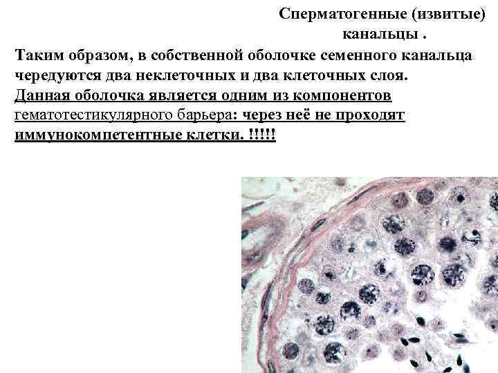 Сперматогенные (извитые) канальцы. Таким Сперматогенные (извитые) канальцы. Таким