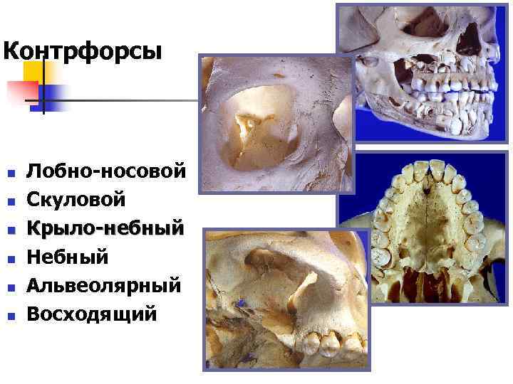Контрфорсы  n  Лобно-носовой n  Скуловой n  Крыло-небный n  Небный