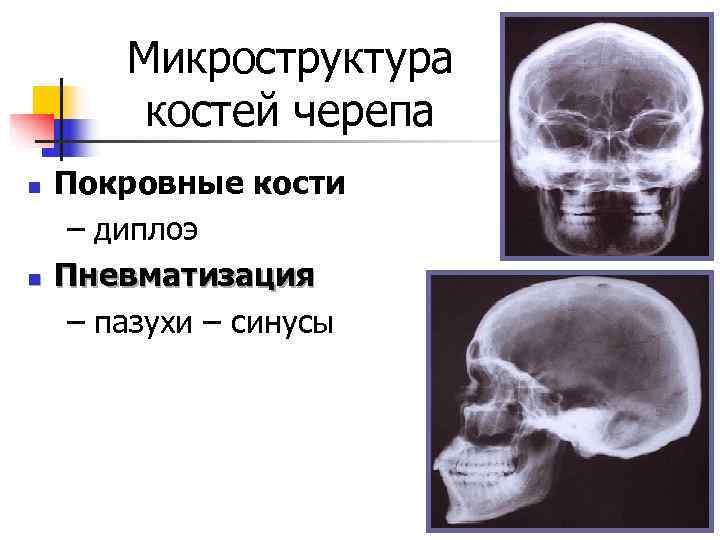   Микроструктура   костей черепа n  Покровные кости – диплоэ n