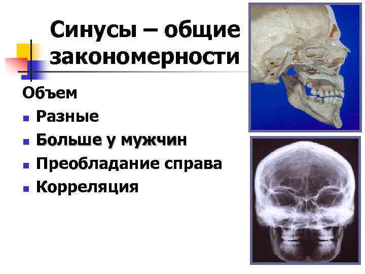  Синусы – общие  закономерности Объем n Разные n Больше у мужчин n