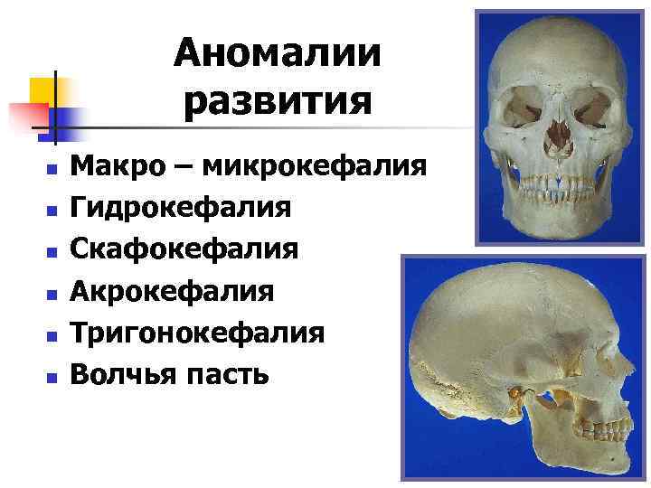    Аномалии   развития n  Макро – микрокефалия n 