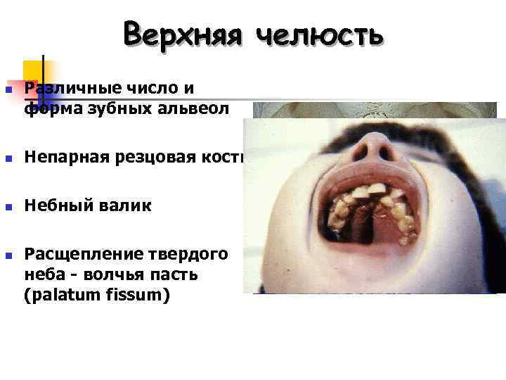    Верхняя челюсть n  Различные число и форма зубных альвеол n