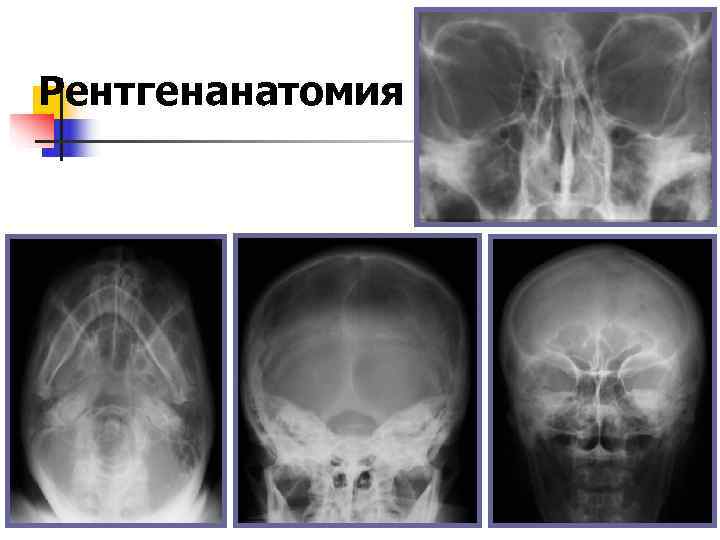 Рентгенанатомия 