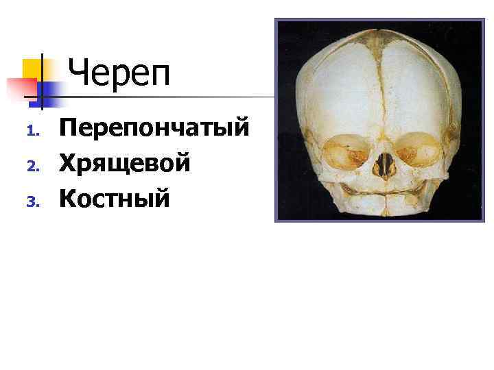  Череп 1.  Перепончатый 2.  Хрящевой 3.  Костный 