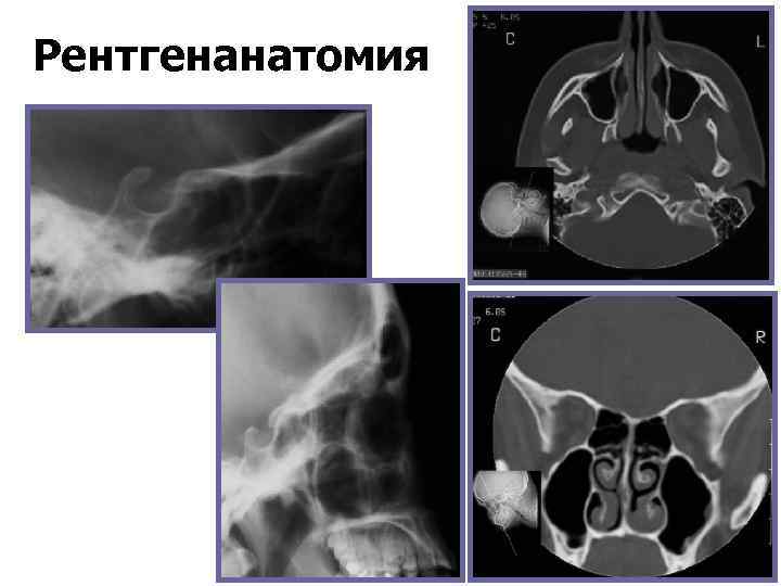 Рентгенанатомия 