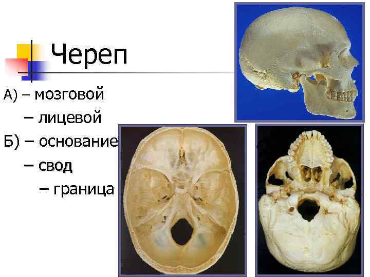 Мозговой череп свод и основание. Свод и основание черепа. Свод черепа и основание черепа.