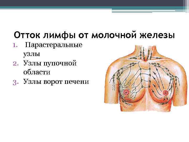 Презентация лимфоотток молочной железы