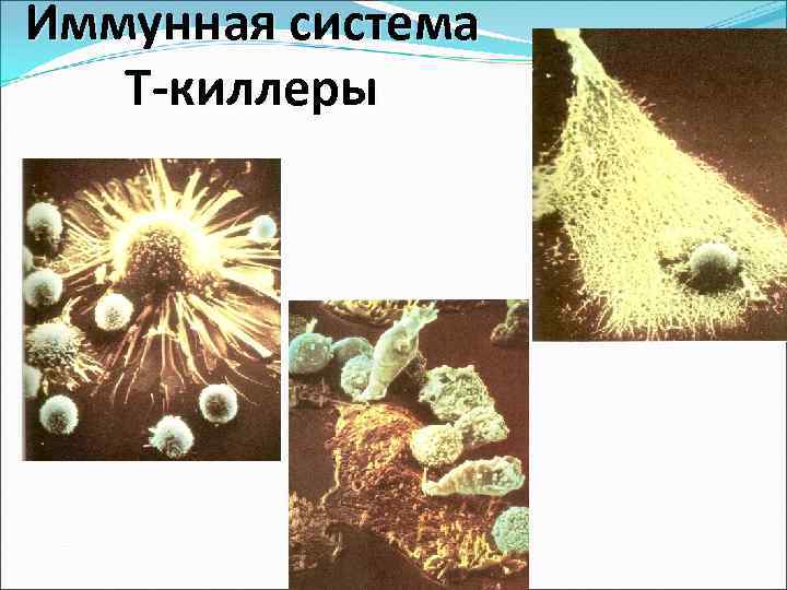 Иммунная система  T-киллеры 