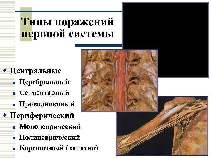  Типы поражений  нервной системы  w Центральные  n  Церебральный 