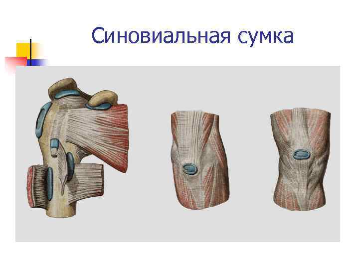 Сумки суставов. Синовиальная сумка. Синовиальные сумки суставов. Подсухожильная синовиальная сумка. Синовиальные сумки примеры.