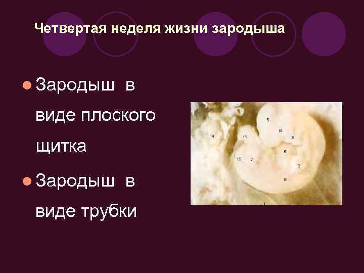 Жизнь в неделях. Щиток эмбрион. Эмбрион в переводе с греческого означает. Эмбрион в виде линейной структуры что это означает.