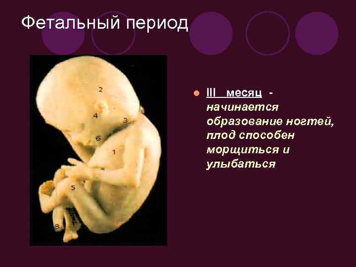 Фетальный период l III месяц начинается образование ногтей, плод способен морщиться и улыбаться 