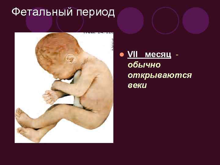 Фетальный период l VII месяц обычно открываются веки 