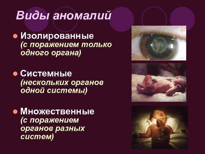 Виды аномалий l Изолированные (с поражением только одного органа) l Системные (нескольких органов одной