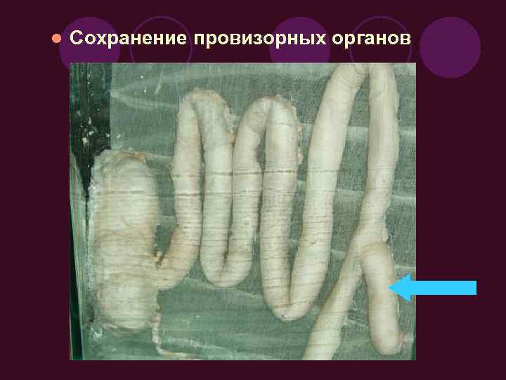 l Сохранение провизорных органов 