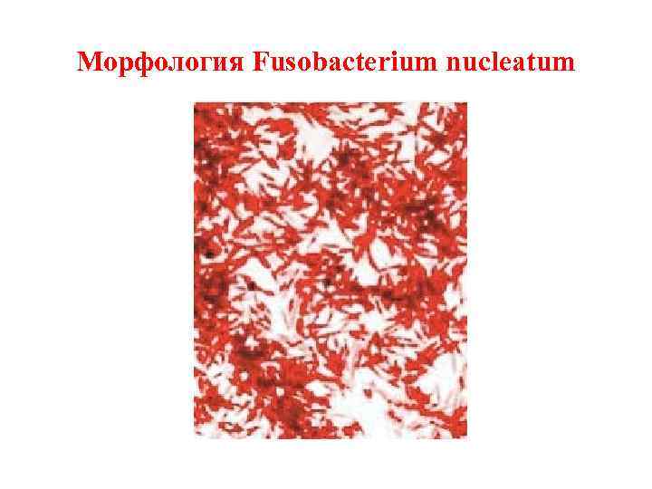 Морфология Fusobacterium nucleatum 