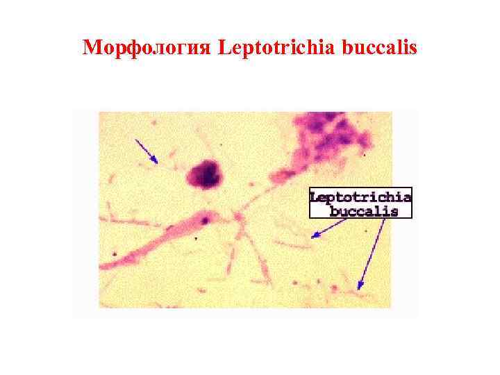 Морфология Leptotrichia buccalis 