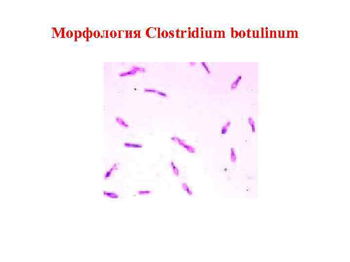 Морфология Clostridium botulinum 