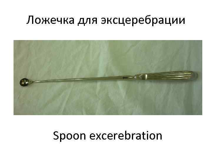 Ложечка для эксцеребрации   Spoon excerebration 