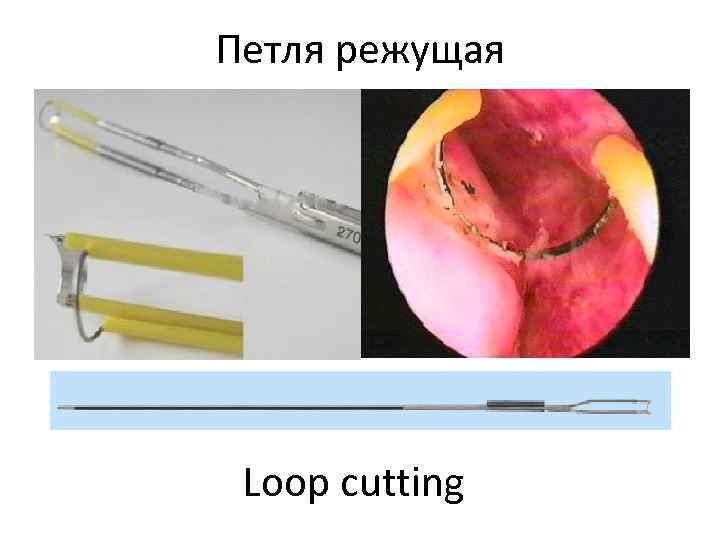 Петля режущая Loop cutting 