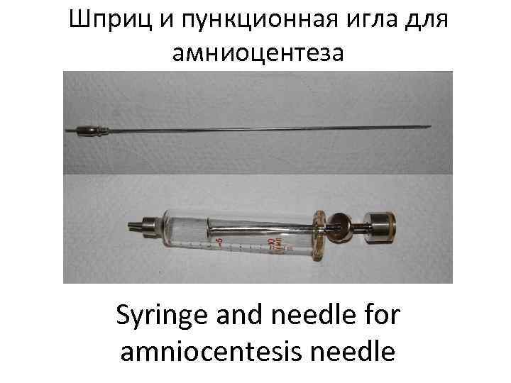 Шприц и пункционная игла для  амниоцентеза  Syringe and needle for  amniocentesis