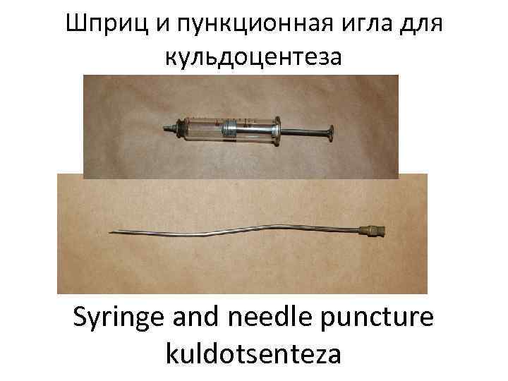 Шприц и пункционная игла для  кульдоцентеза Syringe and needle puncture  kuldotsenteza 