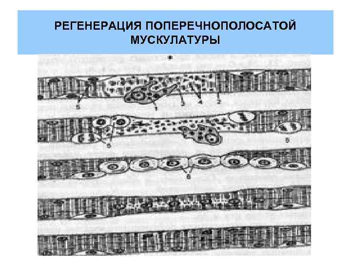 РЕГЕНЕРАЦИЯ ПОПЕРЕЧНОПОЛОСАТОЙ  МУСКУЛАТУРЫ 