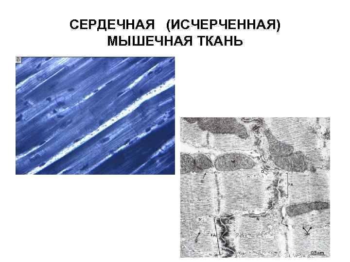 СЕРДЕЧНАЯ (ИСЧЕРЧЕННАЯ) МЫШЕЧНАЯ ТКАНЬ 