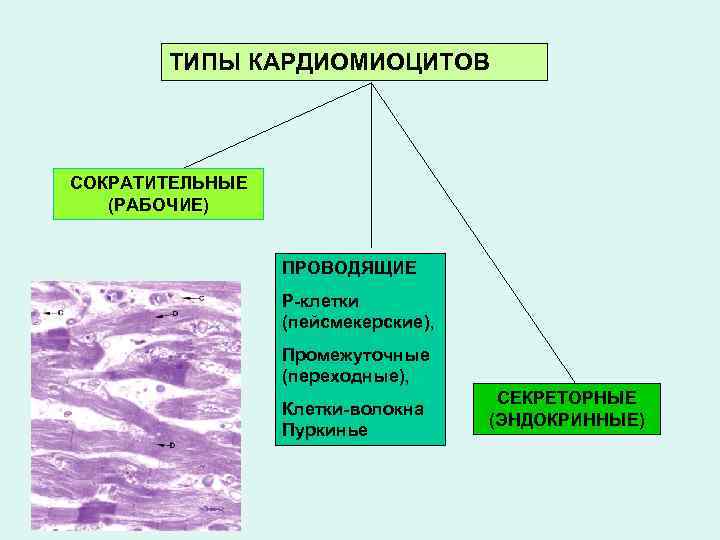   ТИПЫ КАРДИОМИОЦИТОВ  СОКРАТИТЕЛЬНЫЕ  (РАБОЧИЕ)    ПРОВОДЯЩИЕ  