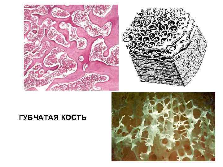 ГУБЧАТАЯ КОСТЬ 