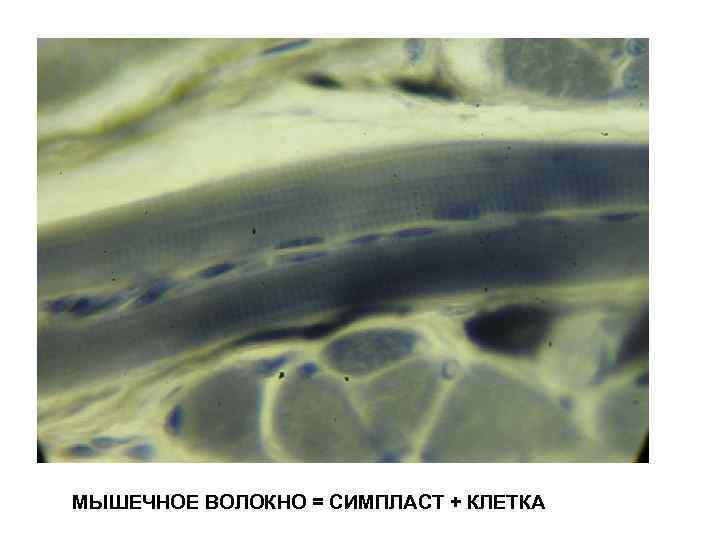 МЫШЕЧНОЕ ВОЛОКНО = СИМПЛАСТ + КЛЕТКА 