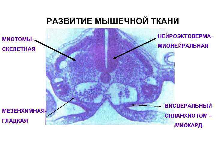     РАЗВИТИЕ МЫШЕЧНОЙ ТКАНИ      НЕЙРОЭКТОДЕРМА- МИОТОМЫ-