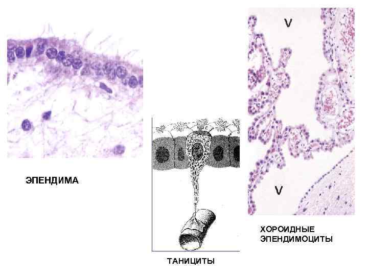 ЭПЕНДИМА      ХОРОИДНЫЕ    ЭПЕНДИМОЦИТЫ   ТАНИЦИТЫ