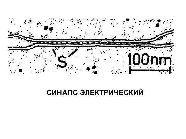 СИНАПС ЭЛЕКТРИЧЕСКИЙ 