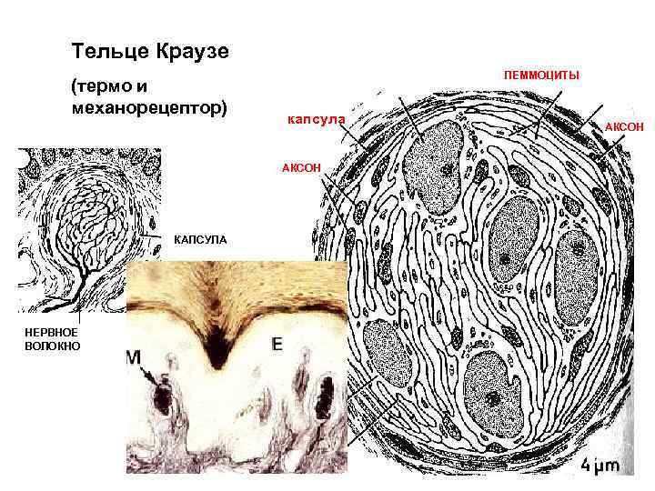 Рассмотрите рисунок ниже и обозначьте структурные компоненты телец пачини