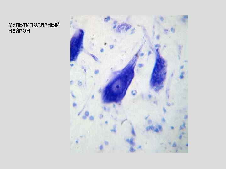 МУЛЬТИПОЛЯРНЫЙ НЕЙРОН 
